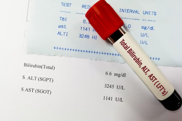 GGT crescut: de ce analiza nu se interpretează izolată