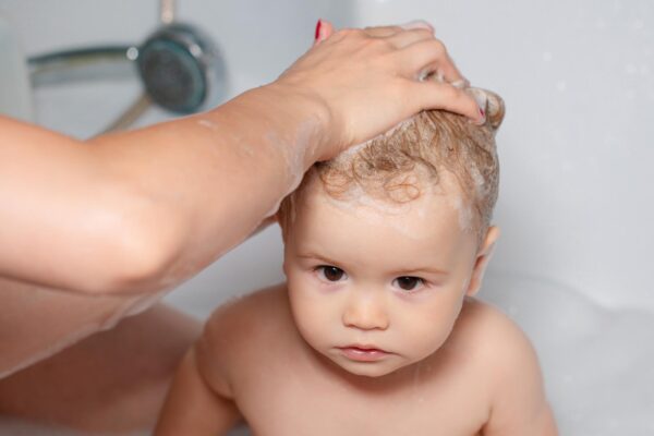 Cruste pe scalpul bebelușului: ce este dermatita seboreică infantilă